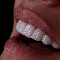 تخفیف های ویژه دندانپزشکی،کامپوزیت زیبایی،عصب کشی|خدمات آرایشگری و زیبایی|آبادان, |دیوار