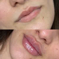 کلینیک دکتر امیررضا مهدویان/ژل بوتاکس لیزر|خدمات زیبایی و سلامت|اهواز, گلستان|دیوار