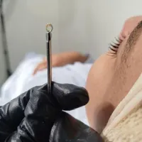 آموزش اصلاح درما