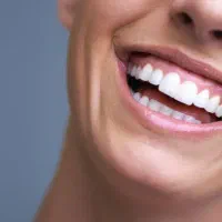 جرم گیری دندون با فقط ۷۰۰ هزار تومن