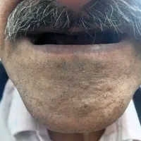 دندانسازی .لابراتوار آریا