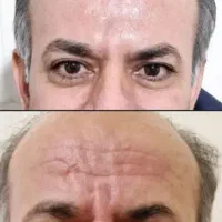 خدمات زیبایی جوانسازی واسه همشهریان بانوان اقایان
