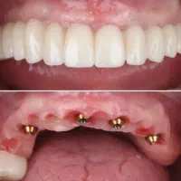 اقساط سیزده ماهه