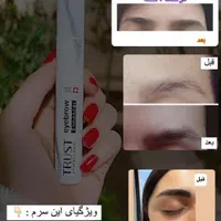 سرم رویش و تقویت ابرو|آرایشی، بهداشتی، درمانی|اصفهان, گلستان|دیوار