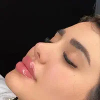 کلینیک زیبایی/بوتاکس/فیلر/مزو ژل/لاغری PRP