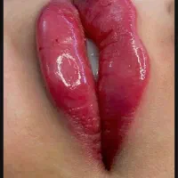 تزریق انواع فیلر (ژل )بوتاکس وخدمات میکروپیگمنتیشن|خدمات آرایشگری و زیبایی|یاسوج, |دیوار