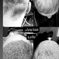 کاشت مو ابرو