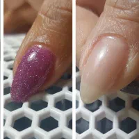 کاشت و ترمیم ناخن