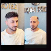 پروتز مو  سنندج|خدمات آرایشگری و زیبایی|سنندج, |دیوار