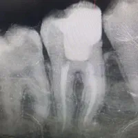 دستیار و پذیرش دندانپزشکی در شهری