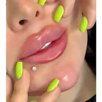 تزریق ژل لب و گونه و چانه.. (جشنواره)درمطب فقط499ت|خدمات آرایشگری و زیبایی|اصفهان, باغ زیار|دیوار