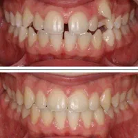 ارتودنسی ارزانتر از تعرفه نظام پزشکی،ایمپلنت فوری|خدمات آرایشگری و زیبایی|تهران, آذربایجان|دیوار