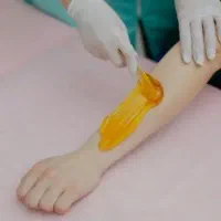اپلاسیون