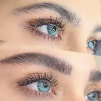 مدل میکروبلیدینگ رایگان