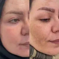 پاک سازی کبدوگوارش