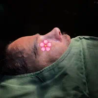 عمل بینی در تهران با قیمت مناسب|خدمات آرایشگری و زیبایی|شهرکرد, |دیوار