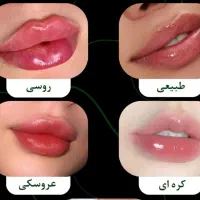 ارزانسرای تخصصی تزریق ژل و بوتاکس