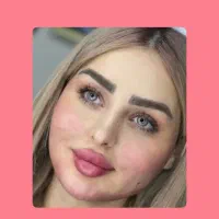 ژل لب / بوتاکس/ فول فیس/ تخفیف ویژه /پزشک کلینیک|خدمات زیبایی و سلامت|مشهد, سناباد|دیوار