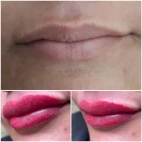 تخفیف ویژه بمدت محدود