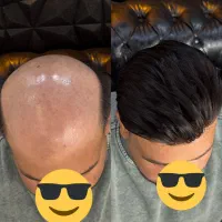 اولین مرکز پروتز و ترمیم مو در بروجرد و غرب کشور