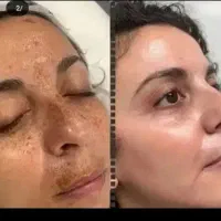 کرم معجزه اصل و کرم عجوبه اصل