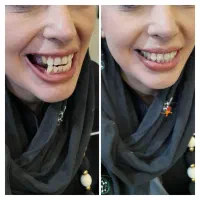لابراتوار دندانسازی دنت یار|خدمات زیبایی و سلامت|تهران, شکوفه|دیوار