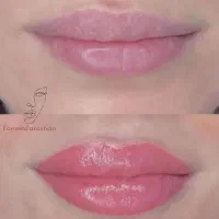 تخفیف ویژه شیدینگ لب ،