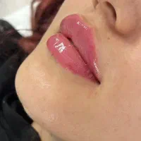 تخفیفات تزریقات توسط پزشک هفته اخر