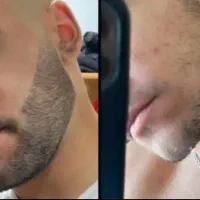 بدون درد کاروجمع کن