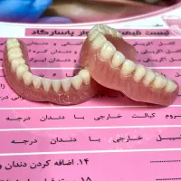 دست دندان مصنوعی و پروتز متحرک|خدمات آرایشگری و زیبایی|اصفهان, شهرک کاوه|دیوار