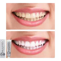 کرم ضدلک|آرایشی، بهداشتی، درمانی|شیراز, شهرک استقلال|دیوار