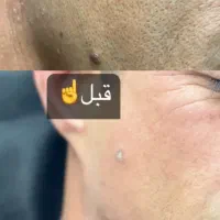 خدمات کلینیک سلامت سپید|خدمات آرایشگری و زیبایی|فولادشهر, A4|دیوار