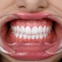 اقساط بلند مدت