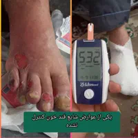 پرستاری در منزل(سرم تراپی،تزریقات،زخم)۲۶ سابقه کا|خدمات آرایشگری و زیبایی|برازجان, |دیوار