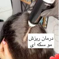 فیشیال و پاکسازی پوست واسکراپ اسکالپ سر مو فقط ۳۸۰|خدمات آرایشگری و زیبایی|مشهد, هنرستان|دیوار