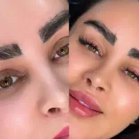 کاشت مژه ، ناخن ، فیشیال