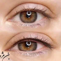 میکروبلیدینگ ،رژلب،ریموو