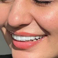 کامپوزیت دندان جشنواره یلدایی و روز مادر