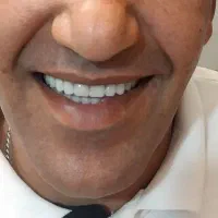 انجام تمامی خدمات پروتز های دندانی متحرک