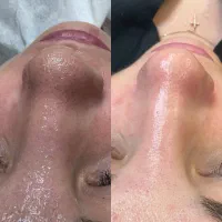 فیشال تخصصی بانوان و آقایان*کلینیک لیان|خدمات آرایشگری و زیبایی|شهریار, شهریار|دیوار