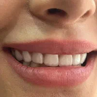 جشنواره پاییژه دندانپزشکی