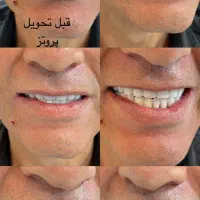 دندان مصنوعی|خدمات آرایشگری و زیبایی|پرند, فاز ۲|دیوار