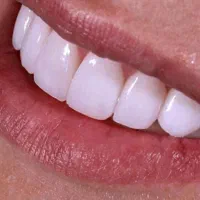 لابراتوار دندانسازی