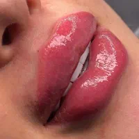 جشنواره ویژه ژل و بوتاکس|خدمات آرایشگری و زیبایی|اردبیل, |دیوار