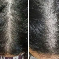 روغن تقویت مو