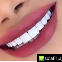 کامپوزیت دندان، روکش، دندانپزشکی تخصصی صدف تهرانسر|خدمات آرایشگری و زیبایی|تهران, تهرانسر مرکزی|دیوار