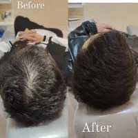 کلینیک تخصصی مزوتراپی و ژل و بوتاکس