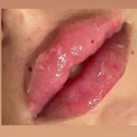 آموزش و انجام تمام خدمات ژل و بوتاکس|خدمات آرایشگری و زیبایی|هشتگرد, شهرک ولیعصر (مصلی)|دیوار