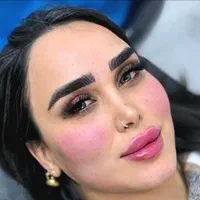 طرح تخفیفی ویژه افتتاحیه شعبه جدید کلینیک|خدمات آرایشگری و زیبایی|کرج, گلشهر|دیوار
