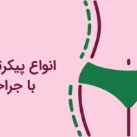 جشنواره ویژه پیکرتراشی، لیپو، ابدو، زیبایی بدن|خدمات آرایشگری و زیبایی|شاهین‌شهر, مخابرات (شهید بهشتی)|دیوار